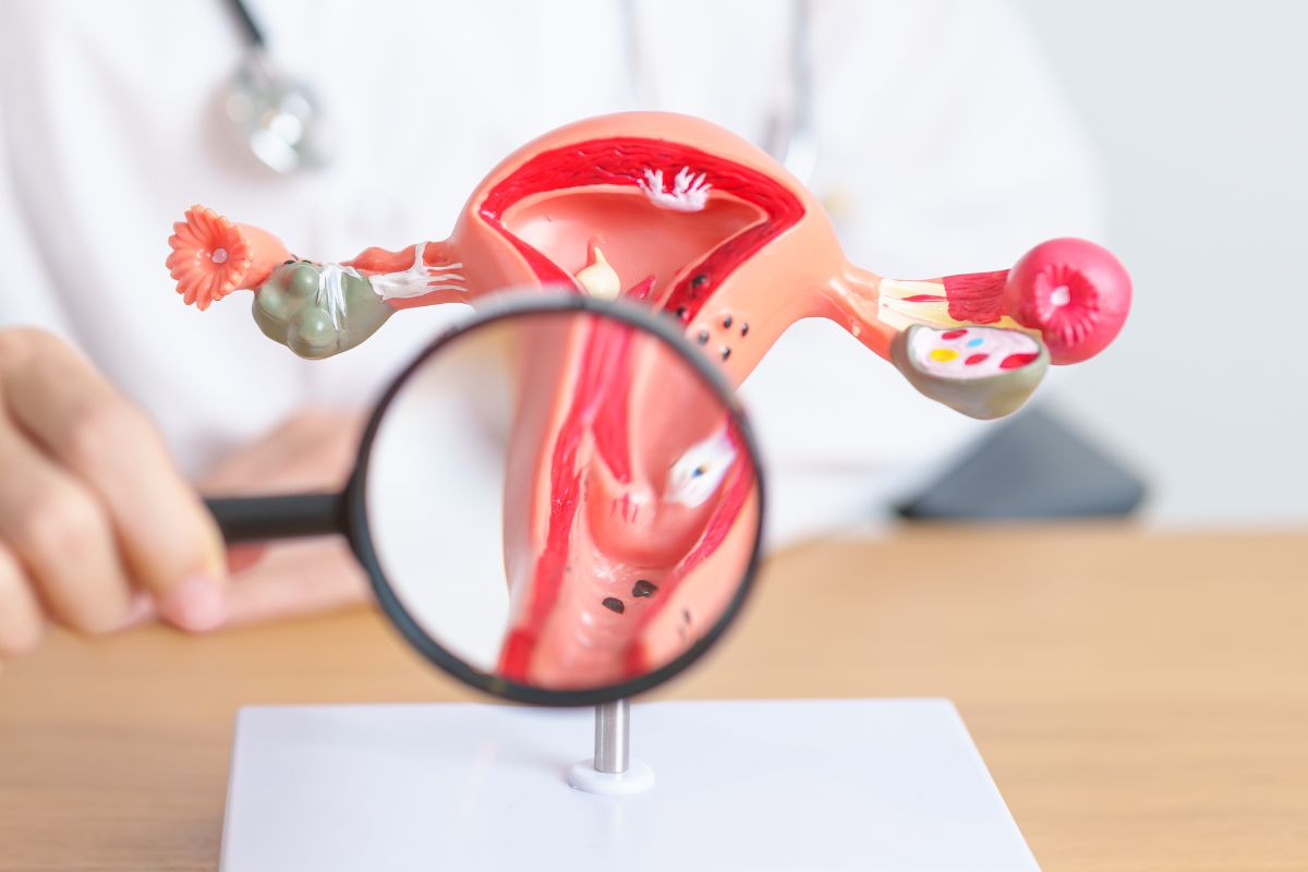 inflamacao e endometriose